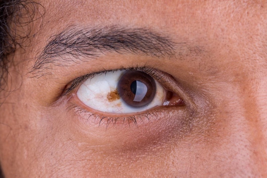 Cyclophosphamide and Eye Health: Managing Ocular Complications